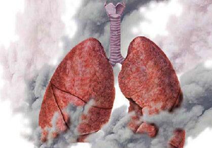 慢阻肺有哪些症状表现